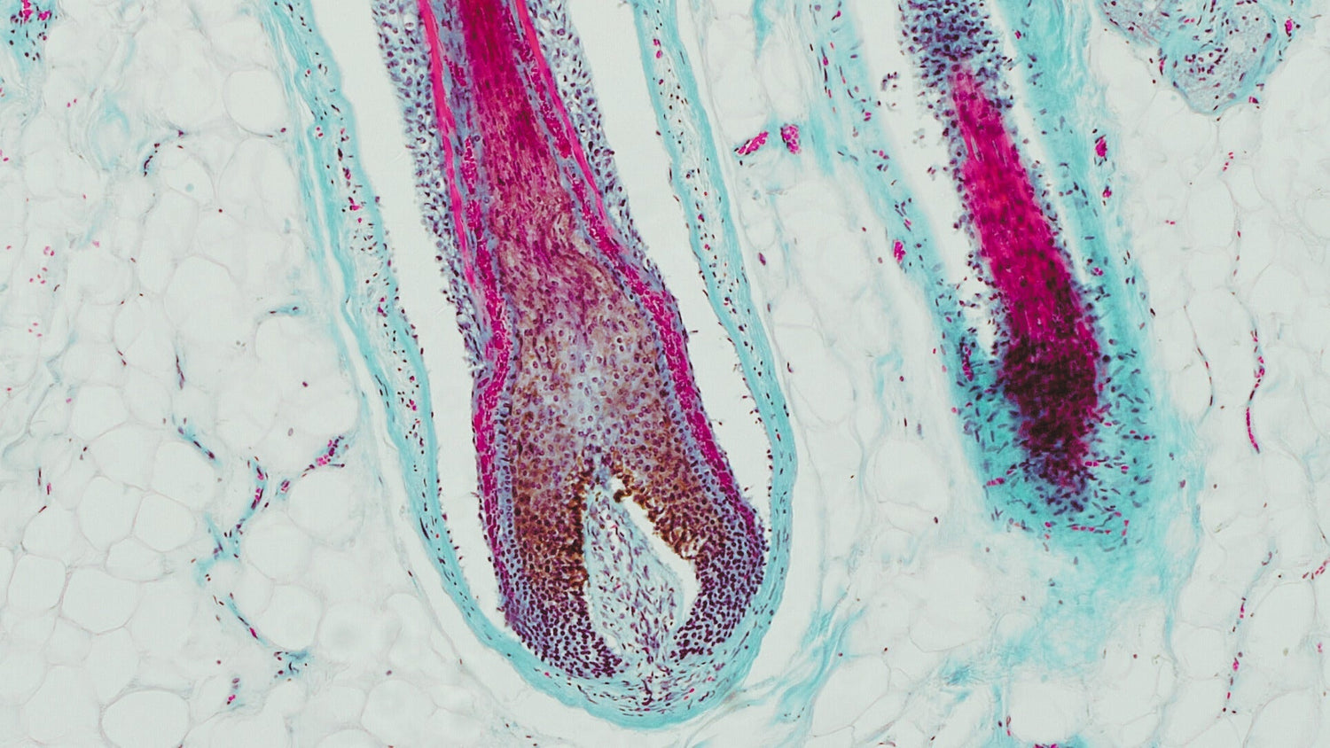 Cysteine & Hair Strength: How one amino acid shapes tensile strength